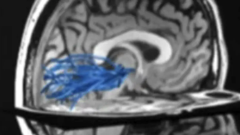 Differential spatial computations in ventral and lateral face-selective regions are scaffolded by structural connections